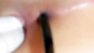 Extreme Close-ups of Suppository Insertion and Other Anal Doctor Games