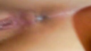 Extreme Close-ups of Suppository Insertion and Other Anal Doctor Games